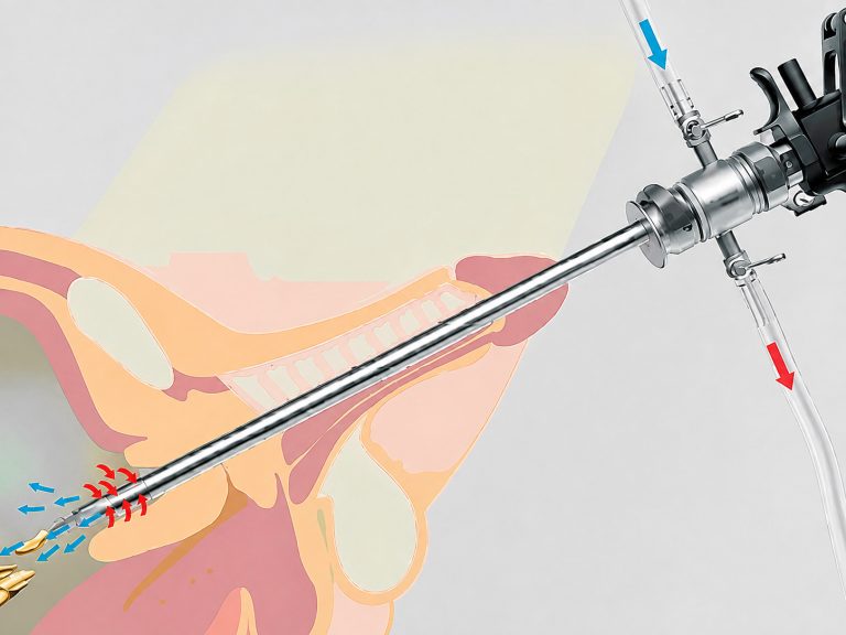Cystoscopy and TUR